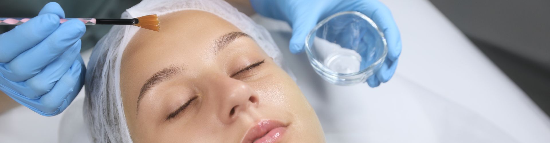 chemical peel at Advanced Skincare