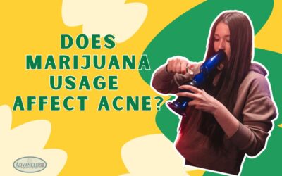 Does Marijuana Usage Affect Acne?